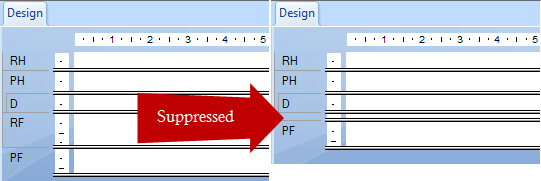 Suppressed-01.png
